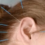 Tratamento de acupuntura para cessação tabágica e redução do craving em Lisboa Acupuncture treatment for smoking cessation and craving reduction in Lisbon