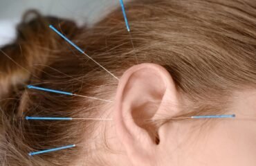 Tratamento de acupuntura para cessação tabágica e redução do craving em Lisboa