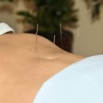 Sessão de acupuntura para fertilidade na Five Clinic Lisboa — medicina integrativa e reprodutiva