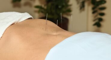 Acupuntura Fertilidade Lisboa — Five Clinic Sessão de acupuntura para fertilidade na Five Clinic Lisboa — medicina integrativa e reprodutiva