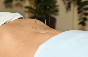 Acupuntura Fertilidade Lisboa — Five Clinic Sessão de acupuntura para fertilidade na Five Clinic Lisboa — medicina integrativa e reprodutiva